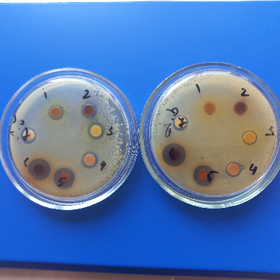 HA_AgNPS_PEs_A.baumanii_antimicrobial activity.jpg