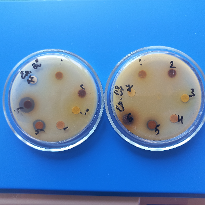 HA_AgNPS_PEs_E.cloacae_antimicrobial activity.jpg