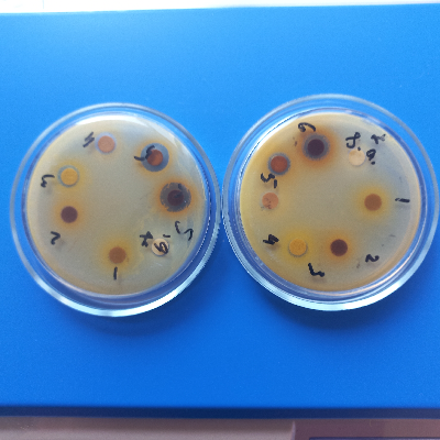 HA_AgNPS_PEs_S.aureus_antimicrobial activity.jpg