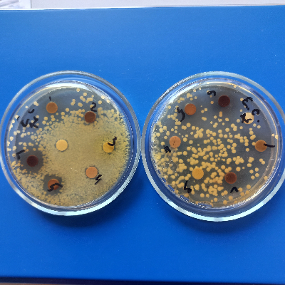 HA_AgNPS_PEs_E.coli_antimicrobial activity.jpg