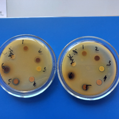 HA_AgNPS_PEs_K.pneumiae_antimicrobial activity.jpg