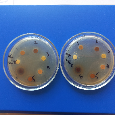 HA_AgNPS_PEs_E.faecalis_antimicrobial activity.jpg